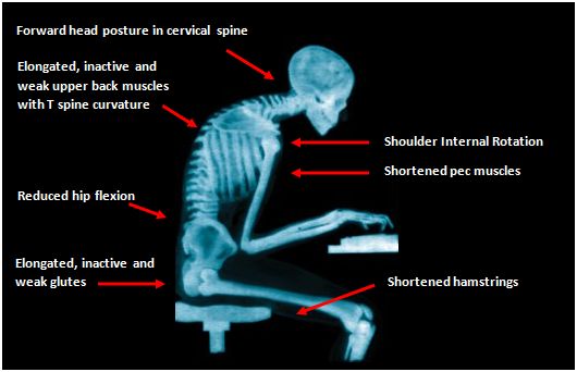 posture - SHIFTfit Personal Trainer Zürich Bootcamp